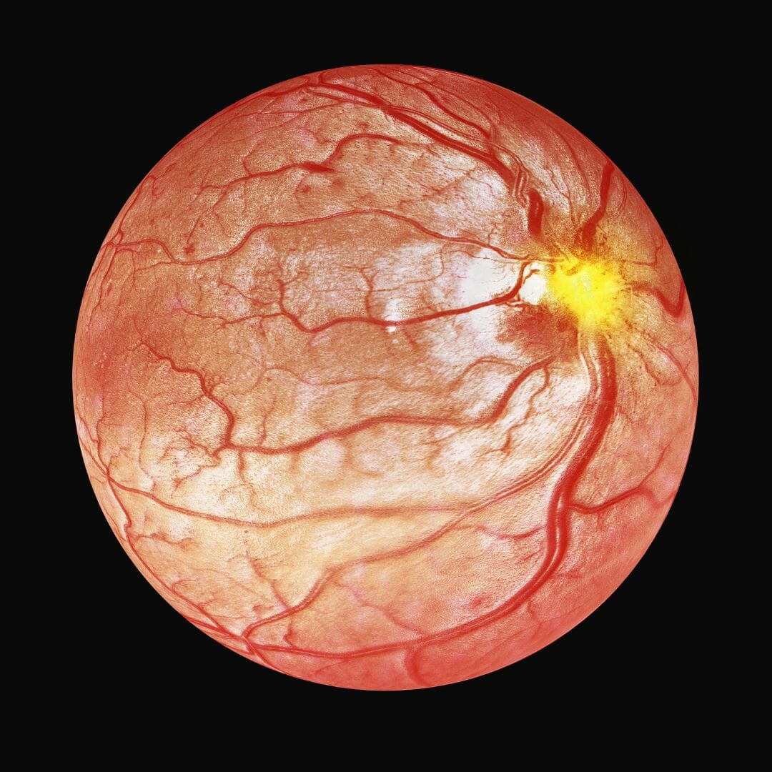 Optical Coherence Tomography image of blood veins inside the eye.