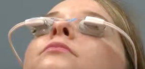 A young woman wearing Lipiflow dry eye treatment eyelid connections.